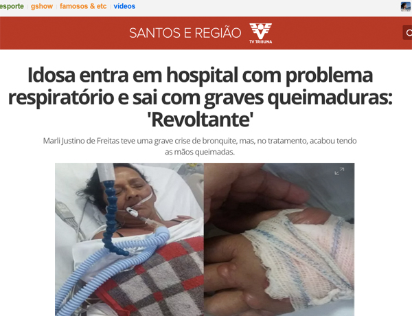 idosa-na-upa-queimada