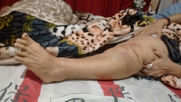 perna-machucada-solangesite