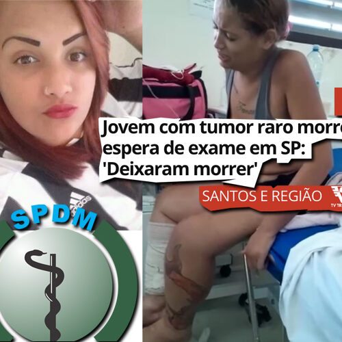 cancer_quadril
